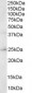 Goat Anti-ABAD / HADH2 Antibody