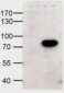 Goat Anti-ABCD1 Antibody