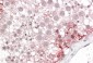 Goat Anti-ABCD3 Antibody