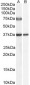 Goat Anti-ACOX2 (Human) Antibody