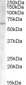 Goat Anti-ACVR1 Antibody