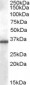 Goat Anti-AKR1B10 Antibody