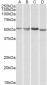 Goat Anti-AKT3 Antibody