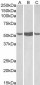 Goat Anti-ALDH1A1 (C Terminus) Antibody