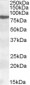 Goat Anti-ALOX15 Antibody