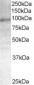 Goat Anti-Androgen Receptor Antibody