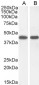 Goat Anti-Argininosuccinate synthetase 1 Antibody