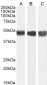 Goat Anti-Argininosuccinate synthetase 1 Antibody