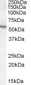 Goat Anti-Arylsulfatase A Antibody