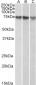 Goat Anti-ATF2 Antibody