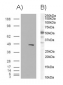 Goat Anti-BAF57 / SMARCE1 Antibody