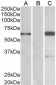 Goat Anti-BAIAP2 (isoform 3) Antibody