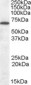 Goat Anti-Cannabinoid Receptor 1 Antibody