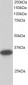 Goat Anti-CBR1 Antibody