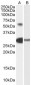 Goat Anti-CHA / TCFL5 Antibody