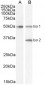 Goat Anti-Chromogranin A precursor Antibody