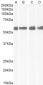 Goat Anti-CRHR1 / CRF-R (aa 107 - 117) Antibody