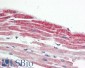 Goat Anti-CSX1 / NKX2-5 Antibody