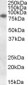 Goat Anti-CYBB / GP91-PHOX Antibody