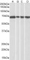 Goat Anti-DDX5 / p68 RNA helicase Antibody
