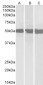 Goat Anti-DEAD-box protein 6 Antibody