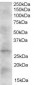 Goat Anti-DKK2 Antibody