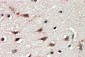 Goat Anti-DYX1C1 (Isoform a) Antibody