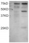 Goat Anti-DYX1C1 (Isoform a) Antibody