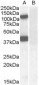 Goat Anti-EPB41L2 / 4.1G (aa 593 to 604) Antibody