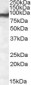 Goat Anti-EWS / EWSR1 Antibody