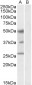 Goat Anti-FOXA1 / HNF3A Antibody