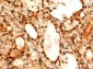 Goat Anti-FOXE1 / TTF2 Antibody