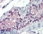 Goat Anti-FOXE1 / TTF2 Antibody