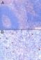 Goat Anti-FOXP3 / SCURFIN Antibody