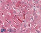 Goat Anti-FTH1 Antibody