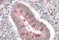Goat Anti-Hamartin / TSC1 (isoform 1) Antibody