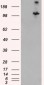 Goat Anti-Hamartin / TSC1 (isoform 1) Antibody