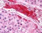 Goat Anti-HRS / HGS Antibody