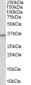 Goat Anti-HSD11B1 / HDL Antibody