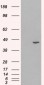 Goat Anti-HSD3B1 Antibody