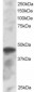 Goat Anti-ICSBP1 / IRF8 Antibody