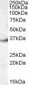 Goat Anti-LASP1 (internal region) Antibody