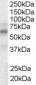 Goat Anti-LXR alpha / LXR beta Antibody