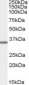 Goat Anti-MRPL3 Antibody