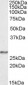 Goat Anti-NDUFS3 Antibody