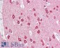 Goat Anti-PACSIN1 Antibody