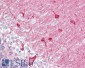 Goat Anti-PACSIN1 Antibody