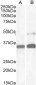 Goat Anti-PAX8 (N Terminus) Antibody