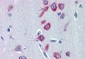 Goat Anti-PCK1 / PEPCKC (internal) Antibody