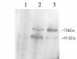 Goat Anti-PCSK9 (C Terminus) Antibody